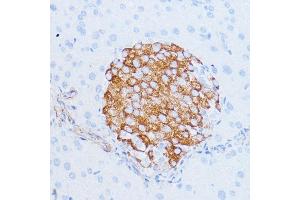 Immunohistochemistry of paraffin-embedded mouse pancreas using NOTCH3 antibody (ABIN6134401, ABIN6144738, ABIN6144739 and ABIN6217553) at dilution of 1:100 (40x lens). (NOTCH3 Antikörper  (C-Term))