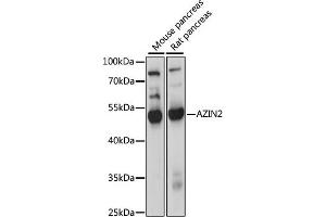 Western blot analysis of extracts of various cell lines, using  antibody (ABIN7265663) at 1000 dilution. (ADC Antikörper  (AA 1-360))