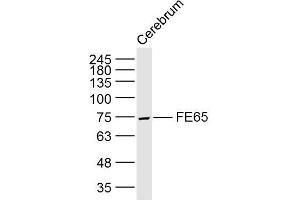 Lane 1: Rat cerebrum lysates probed with FE65 Polyclonal Antibody, Unconjugated (bs-0110R) at 1:300 overnight at 4˚C. (FE65 Antikörper  (AA 201-300))