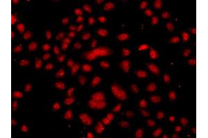 Immunofluorescence analysis of A549 cells using FBXW11 antibody (ABIN5975739). (FBXW11 Antikörper)