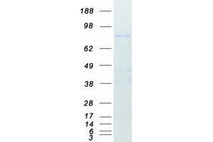 Western Blotting (WB) image for Amyloid beta (A4) Precursor Protein (APP) (Transcript Variant 3) protein (Myc-DYKDDDDK Tag) (ABIN2714677)