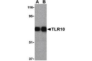 Western Blotting (WB) image for anti-Toll-Like Receptor 10 (TLR10) (Middle Region) antibody (ABIN1031128)