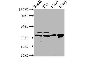 Western Blot Positive WB detected in: HepG2 whole cell lysate, PC-3 whole cell lysate, Rat liver tissue, Mouse liver tissue All lanes: E2F5 antibody at 5 μg/mL Secondary Goat polyclonal to rabbit IgG at 1/50000 dilution Predicted band size: 38, 21 kDa Observed band size: 38 kDa (E2F5 Antikörper  (AA 193-298))
