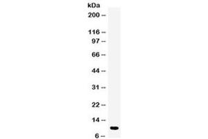 Western blot testing of human placenta lysate with DBI antibody at 0. (Diazepam Binding Inhibitor Antikörper  (AA 2-187))