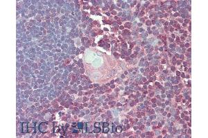 Immunohistochemistry (IHC) image for anti-Interferon gamma (IFNG) (AA 23-156) antibody (ABIN7429433)