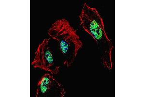 Fluorescent confocal image of Hela cell stained with RARB Antibody (Center) (ABIN1537931 and ABIN2849656).