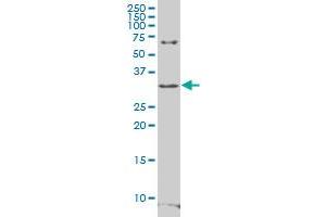 RFPL4B polyclonal antibody (A01), Lot # 060703JCS1. (RFPL4B Antikörper  (AA 127-226))