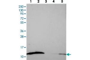 Western blot analysis of Lane 1: RT-4, Lane 2: U-251 MG, Lane 3: Human Plasma, Lane 4: Liver, Lane 5: Tonsil with S100A16 polyclonal antibody  at 1:250-1:500 dilution. (S100A16 Antikörper)