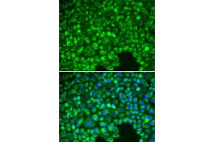 Immunofluorescence analysis of HeLa cells using NFKBIA antibody.