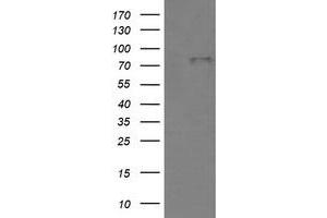Image no. 1 for anti-Bone Morphogenetic Protein 1 (BMP1) (AA 225-617) antibody (ABIN1491232)