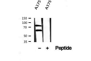 Western blot analysis of extracts from A375, using Melanophilin antibody. (Melanophilin Antikörper  (C-Term))