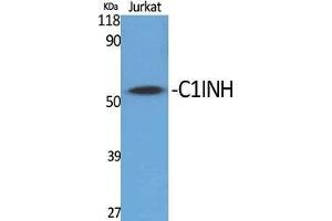 Western Blot (WB) analysis of specific cells using C1INH Polyclonal Antibody. (SERPING1 Antikörper  (Internal Region))