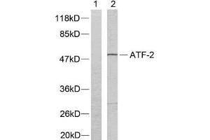 Western blot analysis of extracts from LOVO cells using ATF-2 (Ab-73 or 55) antibody (E021032). (ATF2 Antikörper)