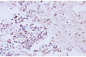 Immunohistochemistry of paraffin-embedded Human muscularis mucosa of the colon tissue using CCNL2 Polyclonal Antibody at dilution of 1:200 (Cyclin L2 Antikörper)