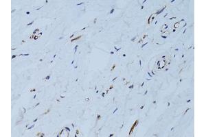 Immunohistochemistry of paraffin-embedded human breast using SELE Antibody (ABIN5971217) at dilution of 1/100 (40x lens). (Selectin E/CD62e Antikörper)