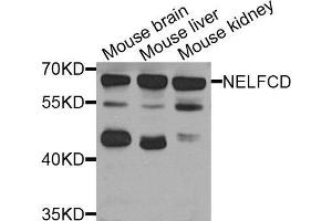 Western Blotting (WB) image for anti-TH1-Like (TH1L) (AA 355-599) antibody (ABIN6220747) (TH1-Like Antikörper  (AA 355-599))