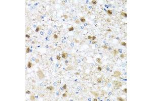 Immunohistochemistry of paraffin-embedded rat brain using ZBTB17 antibody (ABIN5974597) at dilution of 1/100 (40x lens). (ZBTB17 Antikörper)