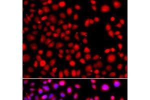 Immunofluorescence analysis of A549 cells using HLX Polyclonal Antibody (HLX Antikörper)