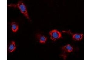 Immunofluorescent analysis of HER2 staining in HeLa cells. (ErbB2/Her2 Antikörper)