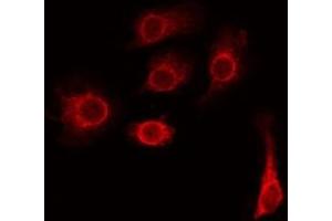 ABIN6276218 staining Hela by IF/ICC. (TMEM185A Antikörper)