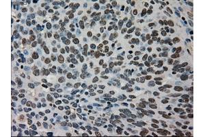Immunohistochemical staining of paraffin-embedded Ovary tissue using anti-TMEM100mouse monoclonal antibody. (TMEM100 Antikörper)