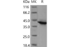 Western Blotting (WB) image for Tumor Necrosis Factor Receptor Superfamily, Member 17 (TNFRSF17) protein (Fc Tag) (ABIN7321207)