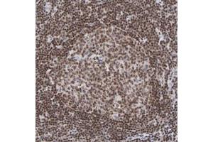 Immunohistochemical staining (Formalin-fixed paraffin-embedded sections) of human lymph node with ZNF143 polyclonal antibody  shows moderate nuclear positivity in reaction center cells and lymphoid cells outside reaction center at 1:20-1:50 dilution.