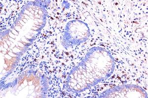 Immunohistochemistry of paraffin-embedded human appendix using C5 Rabbit pAb (ABIN6127535, ABIN6137777, ABIN6137778 and ABIN6219037) at dilution of 1:100 (40x lens). (C5AR1 Antikörper  (AA 250-350))