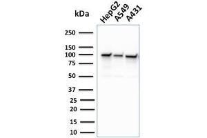 Western Blot Analysis of human HepG2, A549, and A431 cell lysate using MSH2 Mouse Monoclonal Antibody (MSH2/2622). (MSH2 Antikörper  (AA 327-427))