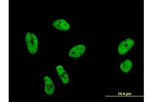 Immunofluorescence (IF) image for anti-Splicing Factor 1 (SF1) (AA 1-110) antibody (ABIN563411)