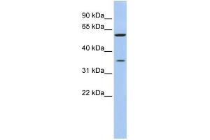 WB Suggested Anti-AKR1B1 Antibody Titration: 0.