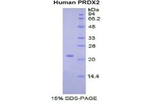 SDS-PAGE of Protein Standard from the Kit  (Highly purified E. (Peroxiredoxin 2 ELISA Kit)