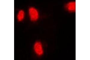 Immunofluorescent analysis of RANGAP1 staining in MCF7 cells. (RANGAP1 Antikörper)