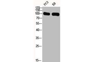 Western Blot analysis of PC3 KB cells using GRIN1 Polyclonal Antibody (GPRIN1 Antikörper  (Internal Region))