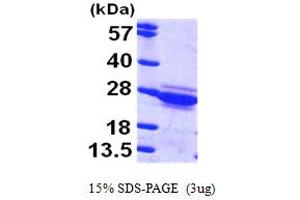 SDS-PAGE (SDS) image for Cytoglobin (CYGB) (AA 1-190) protein (His tag) (ABIN7279055) (CYGB Protein (AA 1-190) (His tag))