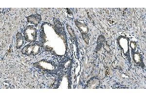 IHC analysis of Carbonic Anhydrase I/CA1 using anti-Carbonic Anhydrase I/CA1 antibody (ABIN7602621). (CA1 Antikörper  (AA 9-261))