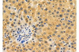 ABIN6265484 and ABIN6276350 at 1/100 staining Rat liver tissue by IHC-P. (TBRG4 Antikörper  (C-Term))