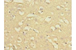 Immunohistochemistry of paraffin-embedded human brain tissue using ABIN7161622 at dilution of 1:100 (Nischarin Antikörper  (AA 500-700))