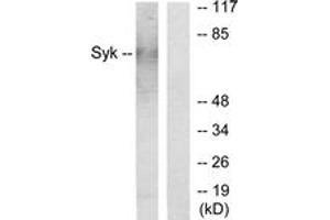 Western Blotting (WB) image for anti-Spleen tyrosine Kinase (SYK) (AA 141-190) antibody (ABIN2889259) (SYK Antikörper  (AA 141-190))