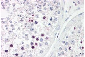 Anti-RFX3 antibody IHC staining of human testis. (RFX3 Antikörper  (AA 641-690))