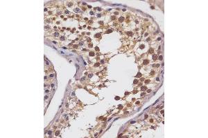 (ABIN6242872 and ABIN6578693) staining SLC2A8 in human testis tissue sections by Immunohistochemistry (IHC-P - paraformaldehyde-fixed, paraffin-embedded sections). (SLC2A8 Antikörper  (AA 260-292))