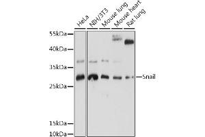 Western blot analysis of extracts of various cell lines, using Snail antibody (ABIN6134928, ABIN6148176, ABIN6148179 and ABIN6215911) at 1:1000 dilution. (SNAIL Antikörper  (C-Term))