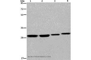 Western blot analysis of 293T and LoVo cell, mouse skin tissue and A172 cell, using ETV7 Polyclonal Antibody at dilution of 1:600