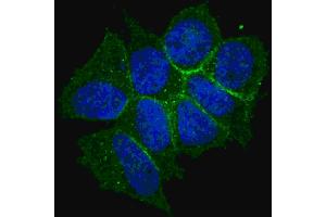 Fluorescent confocal image of MCF7 cells stained with phospho-ERBB2- antibody. (ErbB2/Her2 Antikörper  (pThr1166))