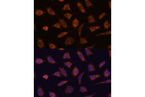 Immunofluorescence analysis of L929 cells using C antibody (ABIN7266029) at dilution of 1:100.