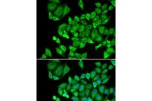 Immunofluorescence analysis of U2OS cells using DHRS9 Polyclonal Antibody (DHRS9 Antikörper)