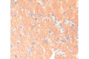 Figure. (BRCA1 Antikörper  (AA 1579-1811))