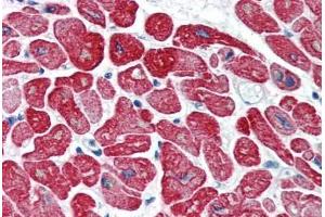 Human Heart (formalin-fixed, paraffin-embedded) stained with TPM1 antibody ABIN337101 at 5 ug/ml followed by biotinylated anti-mouse IgG secondary antibody ABIN481714, alkaline phosphatase-streptavidin and chromogen. (Tropomyosin Antikörper)