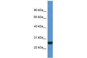 Western Blot showing IL27 antibody used at a concentration of 1 ug/ml against Fetal Lung Lysate (IL-27 Antikörper  (C-Term))