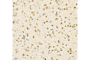Immunohistochemistry of paraffin embedded mouse brain using Kcnh5 (ABIN7075159) at dilution of 1:100 (400x lens) (KCNH5 Antikörper)